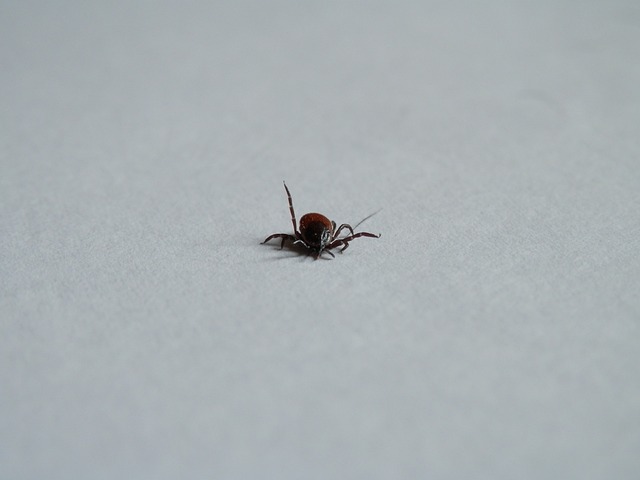 Jak pozbyć się limfy z nóg? Jak pozbyć się limfy z nóg?